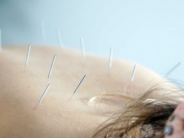 M&M_S16E06_Dr. Susan Newman_Acupuncture Myths