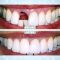 Understanding Cosmetic Dentistry
