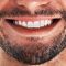 Improving Your Smile At Solo Dental